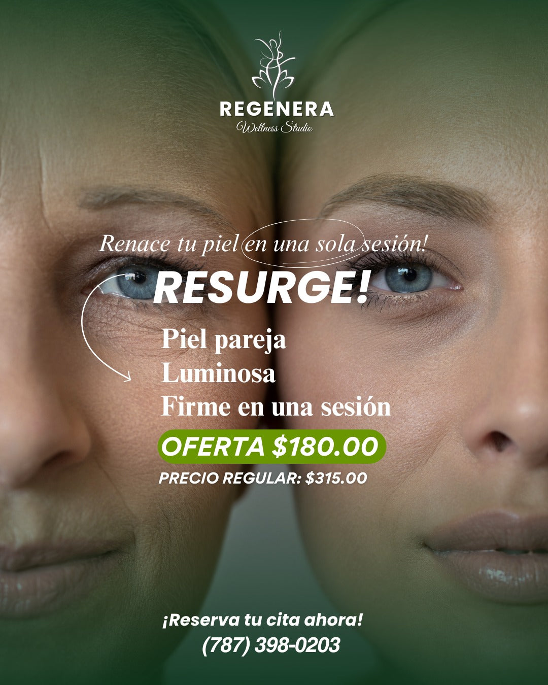 RESURGE Tratamiento más completo limpia, reafirma y regenera tu piel ¡OFERTA!